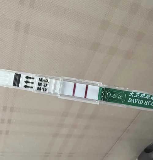 破解卵巢性不孕之谜：揭开女性生育之道的神秘面纱