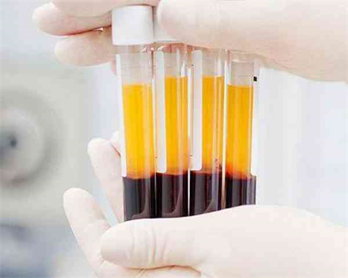 湖北公立捐（供）卵生男孩助孕机构排名前十名单，华中科技大学同济医学院实