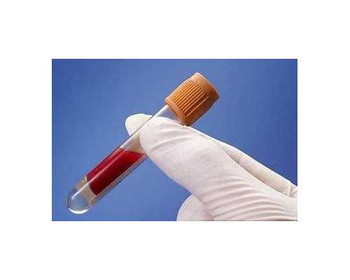 警惕！子宫肌瘤可能导致这些严重果，你知道吗？