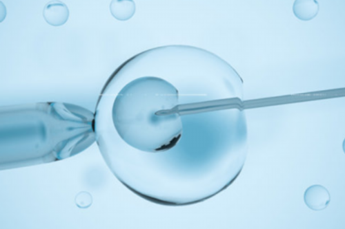 女性卵巢囊肿：揭秘其成因与日常保健