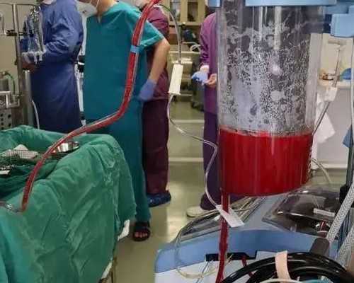 饮食，告别子宫内膜异位症困扰