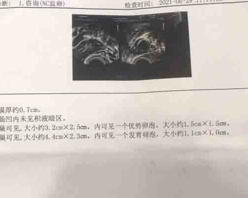 外阴白斑：揭示潜在危害的真相