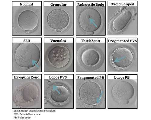 代生子包成功价格_代怀包生男孩,孕期正常上班的好处以及孕期上班需要注意的