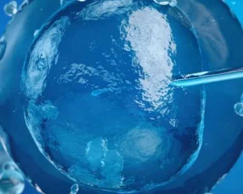 子宫肌瘤的多种发病类型及其特点揭秘