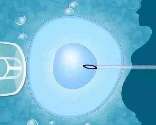 孕期为什么出现妊娠纹 妊娠纹痒怎么办