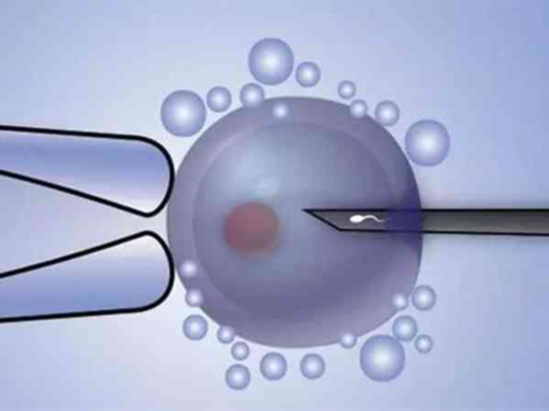 子宫肌瘤的警示：这十种症状让你警醒！