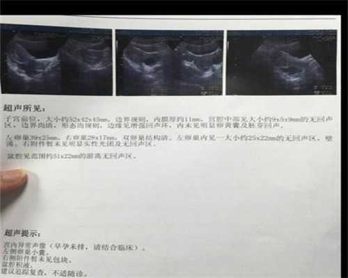 上海代孕：妇科肿瘤逐年年轻化，代孕如何做到