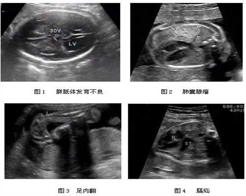 上海可以找代孕吗代孕妇流鼻血是怎么回事，有