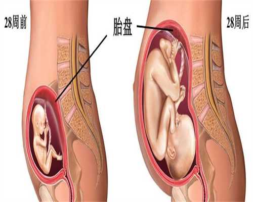 子宫脱垂三个常见疗法解读子宫脱垂四个药方可