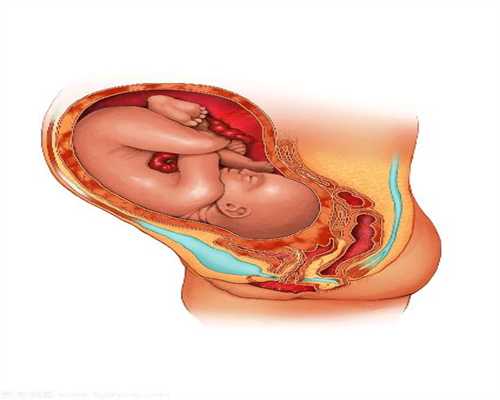 子宫脱垂三个常见疗法解读子宫脱垂四个药方可
