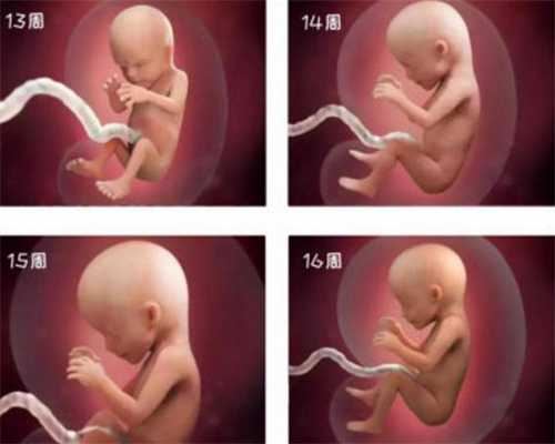 先天性卵巢发育不全综合～仔细留意这些细节，
