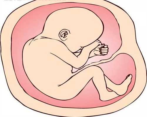 烟台代孕对小孩有影响吗#卵巢发育不全缓解疼痛方法有什么