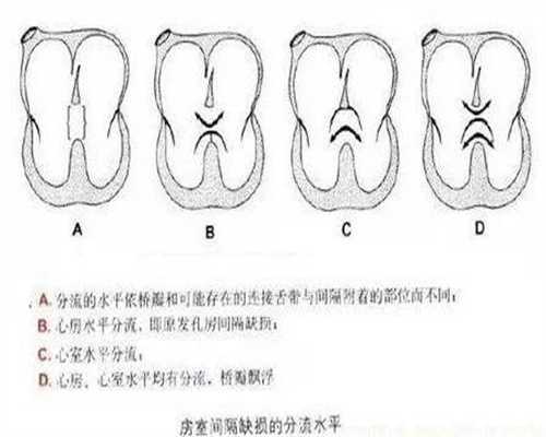 上海代孕中介选神州中泰~先天性卵巢发育不全综合征能试管吗
