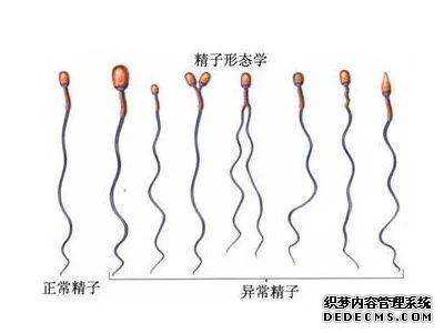武汉代生最靠谱的公司	,[武汉最大的助孕公司]输卵管积水的原因有什么?